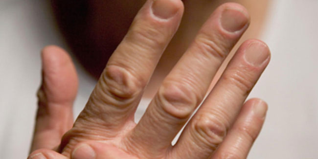 19 October - National Psoriatic Arthritis Day in Canada 19 October - National Psoriatic Arthritis Day in Canada